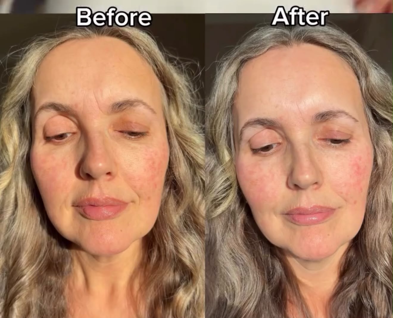 LED Facial Mask in use